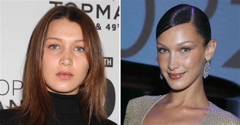 Bella Hadid on Her Plastic Surgery History and Being。